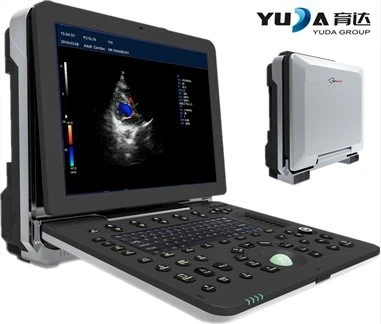 15 ιντσών LED φορητό υπολογιστή χρώμα doppler υπερήχων